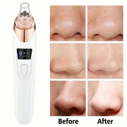 VacuGlow Blackhead Remover