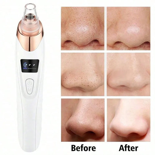 VacuGlow Blackhead Remover