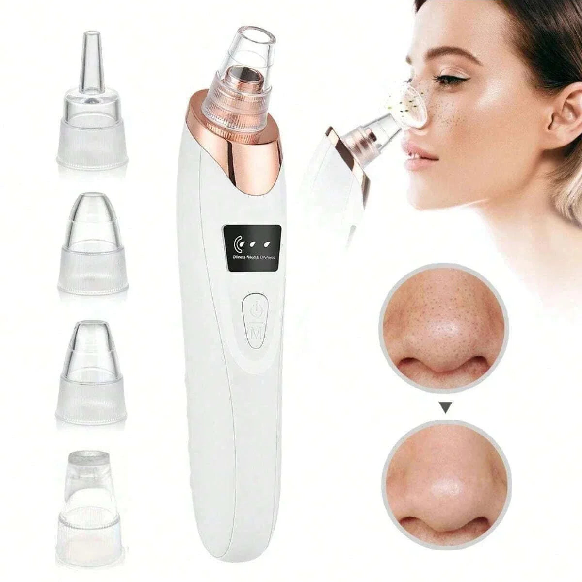 VacuGlow Blackhead Remover