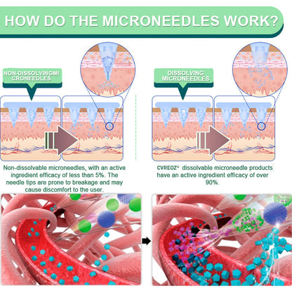 【Last Day Promotion 60% OFF🔥】Cvreoz®NIDDK-Tirzepatide Slimming & health NANO MICRONEEDLE PATCH🇺🇸👨‍⚕️（Zero Pain, 24/7 Release | Lose 20lbs FAST | 90% Sugar Drop | ）🔴