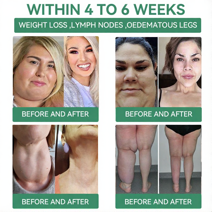 【Last Day Promotion 80% OFF🔥】Cvreoz®NIDDK-Tirzepatide Slimming & health NANO MICRONEEDLE PATCH🇺🇸👨‍⚕️（Zero Pain, 24/7 Release | Lose 20lbs FAST | 90% Sugar Drop | ）🐦‍🔥
