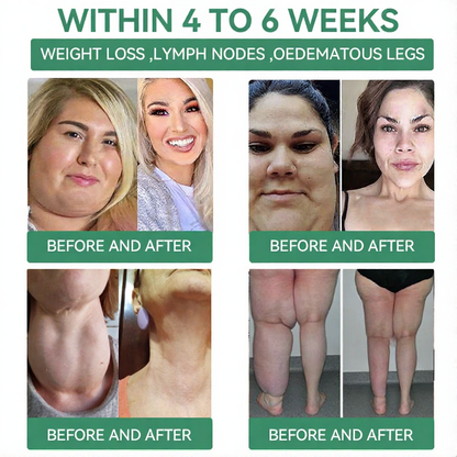 【Last Day Promotion 80% OFF🔥】Cvreoz®NIDDK-Tirzepatide Slimming & health NANO MICRONEEDLE PATCH🇺🇸👨‍⚕️（Zero Pain, 24/7 Release | Lose 20lbs FAST | 90% Sugar Drop | ）🐦‍🔥