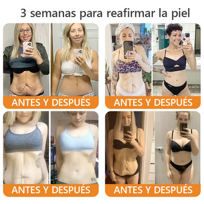 Hecho y enviado desde México🎉Crema restauradora de piel con veneno de abeja EQVP® ⏰ ÚLTIMO DÍA 80% DE DESCUENTO