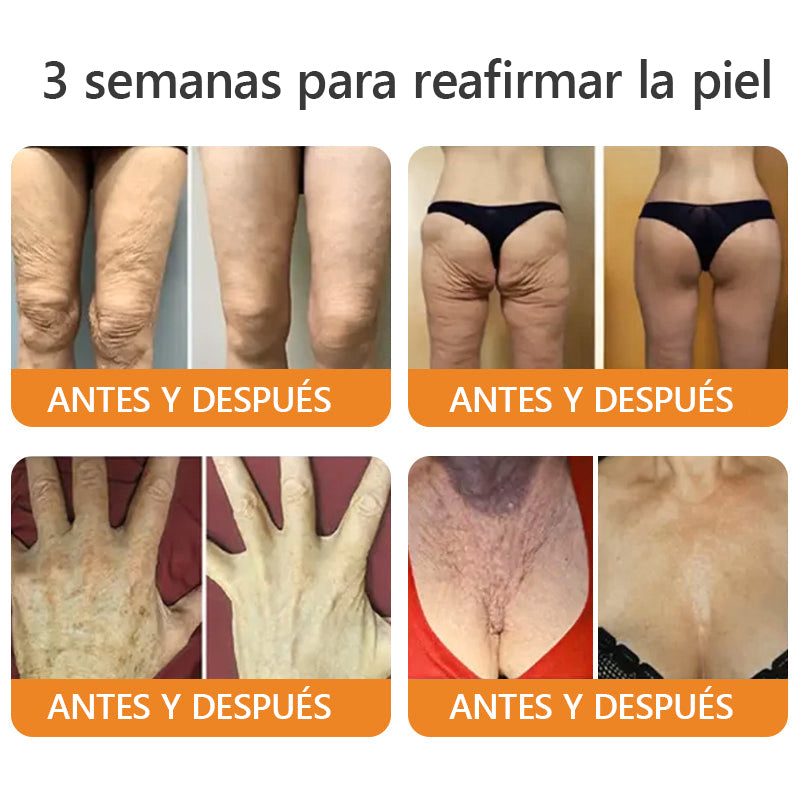 Hecho y enviado desde México🎉Crema restauradora de piel con veneno de abeja EQVP® ⏰ ÚLTIMO DÍA 80% DE DESCUENTO
