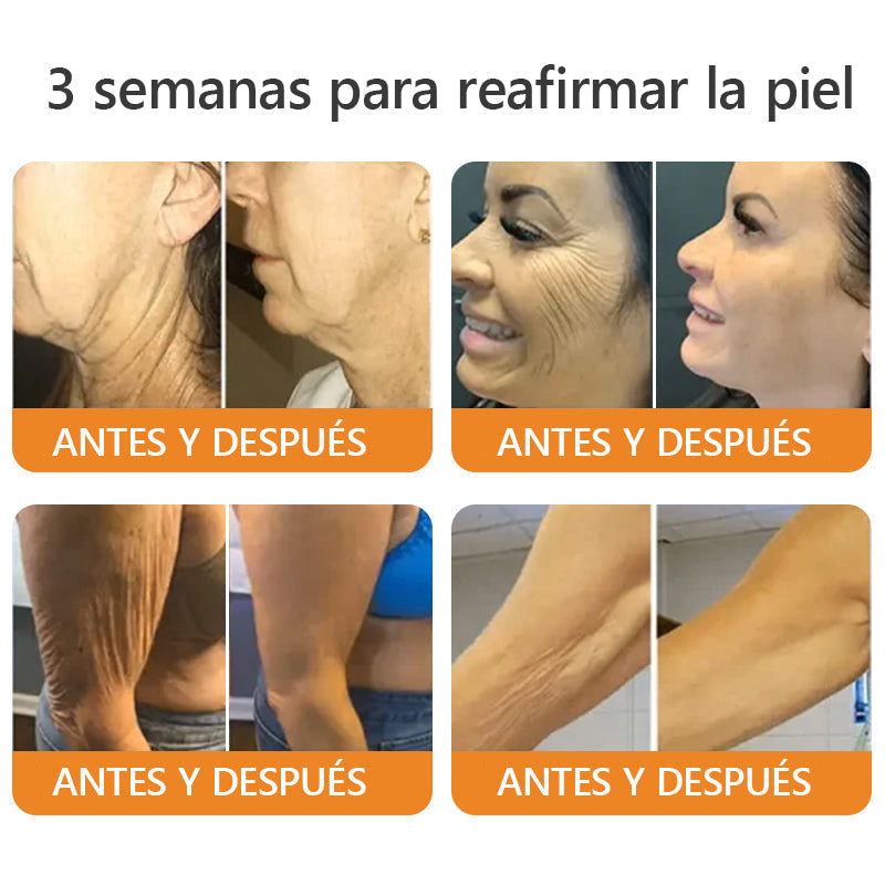 Hecho y enviado desde México🎉Crema restauradora de piel con veneno de abeja EQVP® ⏰ ÚLTIMO DÍA 80% DE DESCUENTO