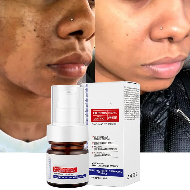 ⚡5-second brightening rescue: Dark spots disappear, blemishes fade, and skin becomes radiant! Vitamin C Whitening Freckles ESSENCE